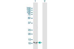 Western Blot analysis of RBP5 expression in transfected 293T cell line by RBP5 MaxPab polyclonal antibody. (Retinol Binding Protein 5 抗体  (AA 1-135))