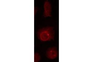 ABIN6267023 staining HuvEc by IF/ICC. (Nibrin 抗体  (pSer278))