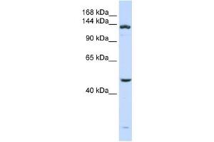 Western Blotting (WB) image for anti-ADAM Metallopeptidase with thrombospondin Type 1 Motif, 18 (ADAMTS18) (N-Term) antibody (ABIN633175)