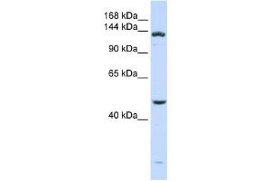 ADAMTS18 antibody used at 1 ug/ml to detect target protein.