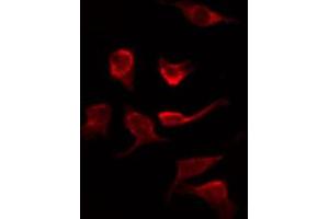 ABIN6267279 staining Hela by IF/ICC. (RAF1 抗体  (pSer621))
