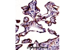Immunohistochemistry (IHC) image for anti-Placental Alkaline Phosphatase (ALPP) antibody (ABIN2998362) (PLAP 抗体)