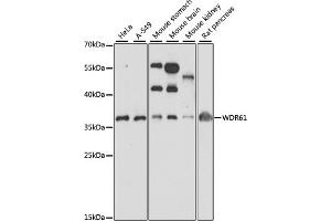 Western blot analysis of extracts of various cell lines, using WDR61 antibody (ABIN7271361) at 1:1000 dilution. (WDR61 抗体  (AA 1-305))