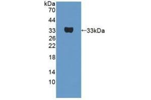 Detection of Recombinant UTRN, Human using Polyclonal Antibody to Utrophin (UTRN) (Utrophin 抗体  (AA 1-252))