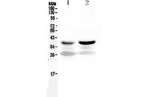 Western blot analysis of MEK6 using anti-MEK6 antibody . (MAP2K6 抗体  (AA 280-334))
