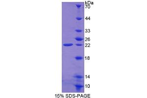 SDS-PAGE analysis of Mouse FTH Protein. (Ferritin, Heavy Polypeptide 1 (FTH1) Peptide)