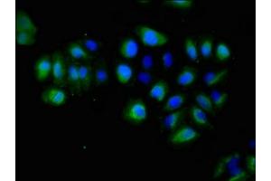 Immunofluorescent analysis of A549 cells using ABIN7151843 at dilution of 1:100 and Alexa Fluor 488-congugated AffiniPure Goat Anti-Rabbit IgG(H+L) (EPH Receptor A5 抗体  (AA 246-514))