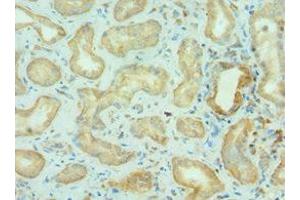 Immunohistochemistry of paraffin-embedded human kidney tissue using ABIN7145825 at dilution of 1:100 (BRD9 抗体  (AA 338-597))