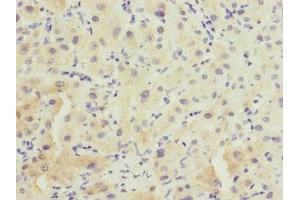 Immunohistochemistry of paraffin-embedded human liver tissue using ABIN7153137 at dilution of 1:100