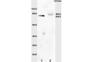 L1 rat intestine lysates L2 mouse embryo lysates probed with Anti phospho-GAB2 (Tyr452) Polyclonal Antibody, Unconjugated (ABIN685288) at 1:200 overnight at 4 °C.