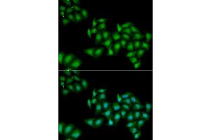 Immunofluorescence (IF) image for anti-DEAD (Asp-Glu-Ala-Asp) Box Polypeptide 1 (DDX1) antibody (ABIN1980256) (DDX1 抗体)