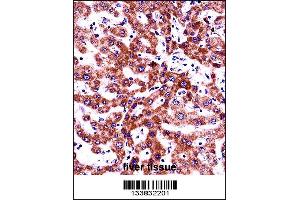 ITGB5 Antibody immunohistochemistry analysis in formalin fixed and paraffin embedded human liver tissue followed by peroxidase conjugation of the secondary antibody and DAB staining. (Integrin beta 5 抗体  (N-Term))