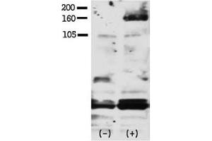 Western blot testing of phospho-HER4 antibody and FG pancreatic carcinoma cells treated with or without EGF (50ng/ml) for 15 min. (ERBB4 抗体  (pTyr1188))
