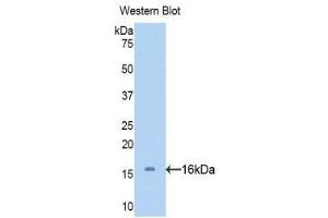 Western Blotting (WB) image for anti-serpin Peptidase Inhibitor, Clade A (Alpha-1 Antiproteinase, Antitrypsin), Member 6 (SERPINA6) (AA 280-405) antibody (ABIN1858268) (SERPINA6 抗体  (AA 280-405))