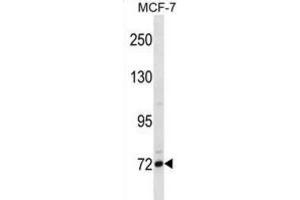 Western Blotting (WB) image for anti-Fc Receptor-Like 5 (FCRL5) antibody (ABIN2998681) (FCRL5 抗体)