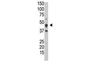 Western Blotting (WB) image for anti-Dual Specificity Phosphatase 6 (DUSP6) (AA 58-89) antibody (ABIN3028626)