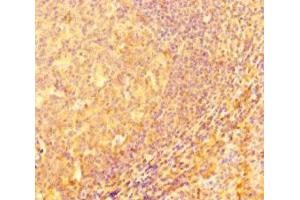 Immunohistochemistry of paraffin-embedded human tonsil tissue using ABIN7156623 at dilution of 1:100 (IRF5 抗体  (AA 214-395))