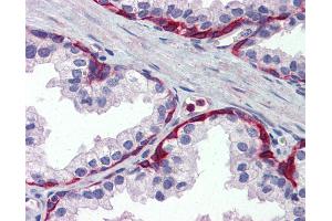 Anti-METTL7A antibody IHC of human prostate.