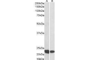 ABIN2564848 (0. (RAC2 抗体  (C-Term))