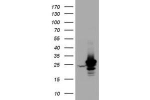Western Blotting (WB) image for anti-Hydroxysteroid (17-Beta) Dehydrogenase 8 (HSD17B8) (AA 57-261) antibody (ABIN2715557) (HSD17B8 抗体  (AA 57-261))
