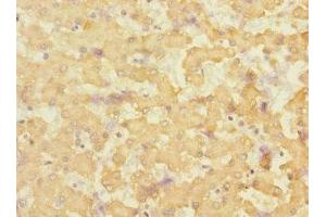 Immunohistochemistry of paraffin-embedded human liver tissue using ABIN7151880 at dilution of 1:100 (Ephrin B3 抗体  (AA 28-226))