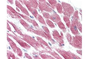Anti-GPR15 antibody IHC of human heart. (GPR15 抗体  (Extracellular Domain))