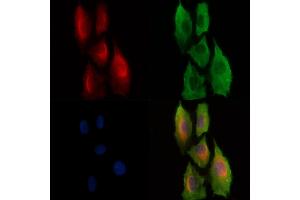 Phospho-PKC theta (Ser695) Antibody staining A549 cells(H2O2 treatment) by IF/ICC. (PKC theta 抗体  (pSer695))