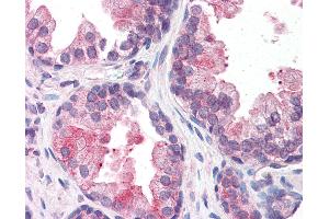 Anti-SMARCD2 antibody IHC of human prostate.