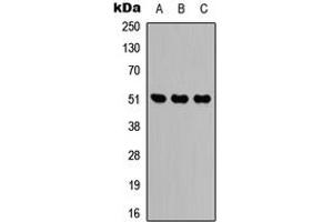 Western blot analysis of IDH2 expression in HEK293T (A), Raw264. (IDH2 抗体  (Center))