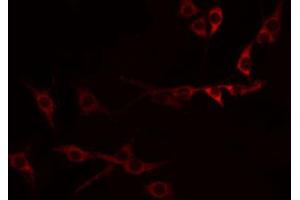 Immunofluorescence (fixed cells) (IF/ICC) image for anti-Tumor Necrosis Factor Receptor Superfamily, Member 9 (TNFRSF9) (Internal Region) antibody (ABIN6256873)