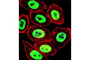 Fluorescent confocal image of U251 cell stained with EWSR1 Antibody . (EWSR1 抗体  (C-Term))