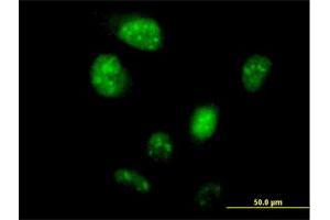 Immunofluorescence of purified MaxPab antibody to LOC148203 on HeLa cell. (ZNF738 抗体  (AA 1-137))