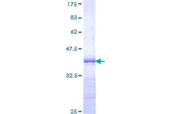 PBX1 Protein (AA 213-321) (GST tag)