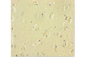 Immunohistochemistry of paraffin-embedded human brain tissue using ABIN7153507 at dilution of 1:100 (GABRQ 抗体  (AA 348-611))