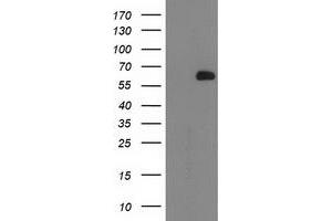 Western Blotting (WB) image for anti-2-Oxoglutarate and Iron-Dependent Oxygenase Domain Containing 1 (OGFOD1) antibody (ABIN1499912) (OGFOD1 抗体)