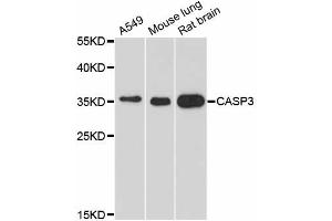 Western blot analysis of extracts of various cell lines, using CASP3 antibody (ABIN5970047) at 1/1000 dilution. (Caspase 3 抗体)