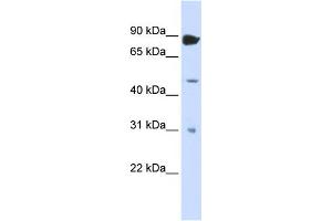 WB Suggested Anti-ADARB1 Antibody Titration:  0.