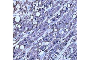 IHC analysis of TRAM1L1 using anti-TRAM1L1 antibody (ABIN7602939).