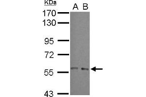 Western Blotting (WB) image for anti-ADP-Ribosylation Factor GTPase Activating Protein 3 (ARFGAP3) (N-Term) antibody (ABIN1493987) (ARFGAP3 抗体  (N-Term))
