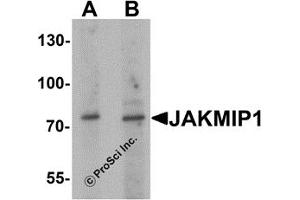Western Blotting (WB) image for anti-Janus Kinase and Microtubule Interacting Protein 1 (JAKMIP1) antibody (ABIN1077419) (JAKMIP1 抗体)