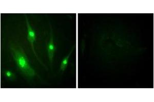 Immunofluorescence analysis of HeLa cells, using GTPase Activating Protein (Ab-387) Antibody. (RACGAP1 抗体  (AA 353-402))