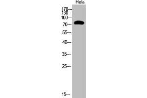 Western Blot analysis of Hela cells using Acetyl-Ub (K48) Polyclonal Antibody (UBA52/RPS27A/UBB/UBC (acLys48) 抗体)