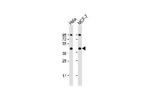Western Blot at 1:1000 dilution Lane 1: Hela whole cell lysate Lane 2: MCF-7 whole cell lysate Lysates/proteins at 20 ug per lane. (ACTR2 抗体  (C-Term))
