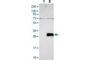 Western blot analysis of Lane 1: Negative control (vector only transfected HEK293T lysate), Lane 2: Over-expression Lysate (Co-expressed with a C-terminal myc-DDK tag (~3. (C6ORF120 抗体)