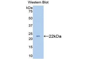 Western Blotting (WB) image for anti-Collagen, Type XVIII (COL18) (AA 1591-1774) antibody (ABIN1077946) (COL18 抗体  (AA 1591-1774))
