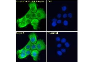 ABIN185477 Immunofluorescence analysis of paraformaldehyde fixed A431 cells, permeabilized with 0.