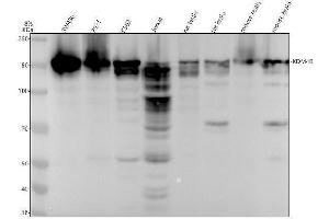 Western blot analysis of KDM4B using anti-KDM4B antibody (ABIN7605363).