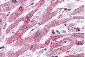 Immunohistochemistry (IHC) image for anti-BCL2-Associated Athanogene 3 (BAG3) (C-Term) antibody (ABIN184770)