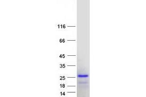 Western Blotting (WB) image for Chromosome 1 Open Reading Frame 144 (C1orf144) (Transcript Variant 1) protein (Myc-DYKDDDDK Tag) (ABIN2715446)
