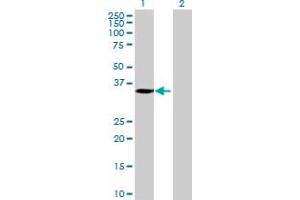 Western Blot analysis of MGC26694 expression in transfected 293T cell line by MGC26694 MaxPab polyclonal antibody. (SLC25A42 抗体  (AA 1-318))